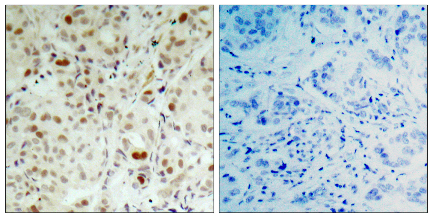 Rb (phospho Ser807) Rabbit Polyclonal Antibody