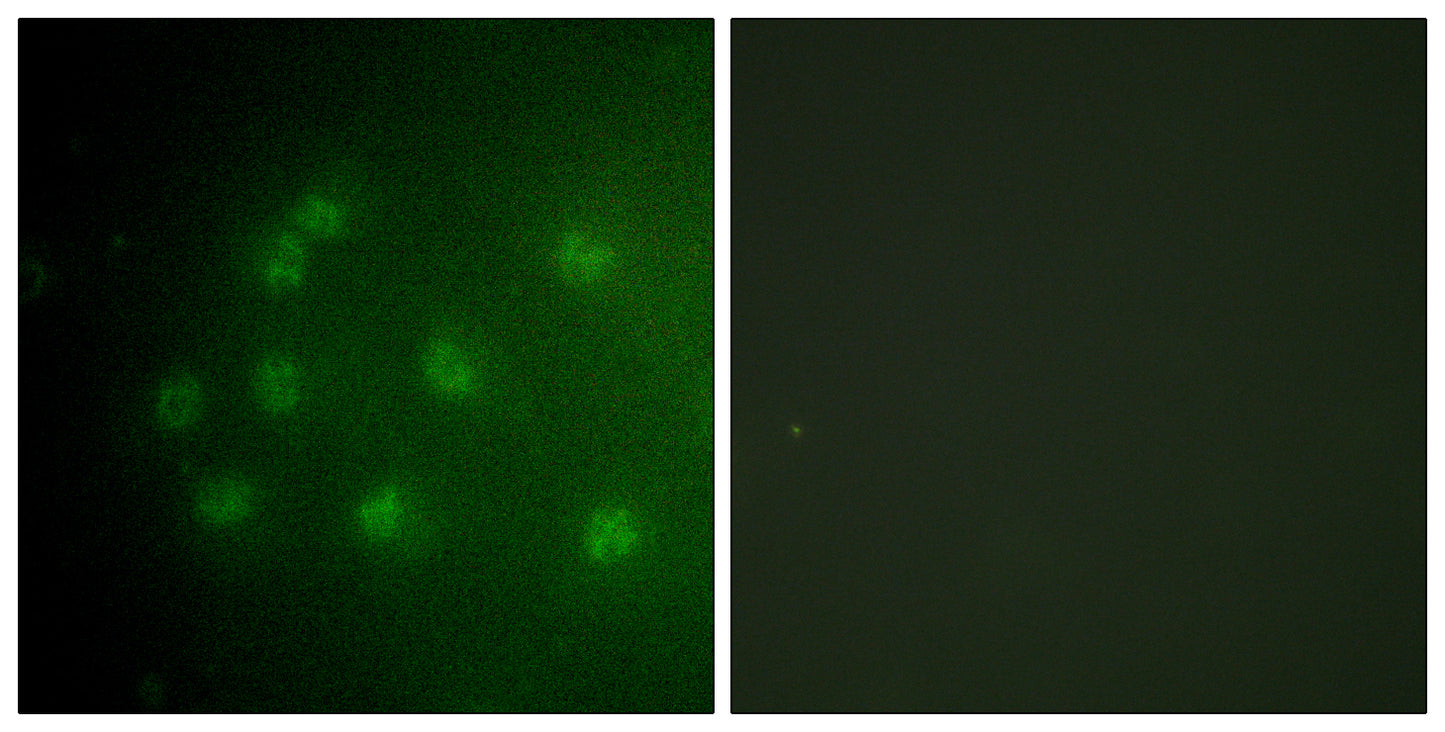 Rb (phospho Thr826) Rabbit Polyclonal Antibody