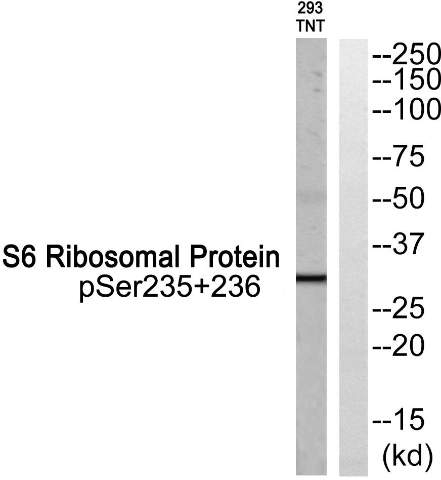 Ribosomal Protein S6 (phospho Ser235/S236) Rabbit Polyclonal Antibody