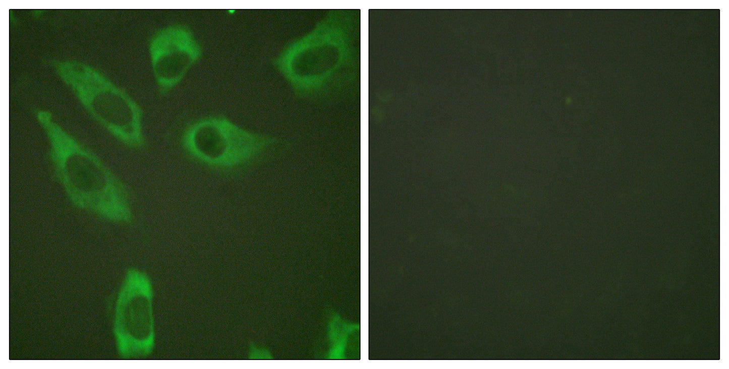 Ribosomal Protein S6 (phospho Ser240) Rabbit Polyclonal Antibody