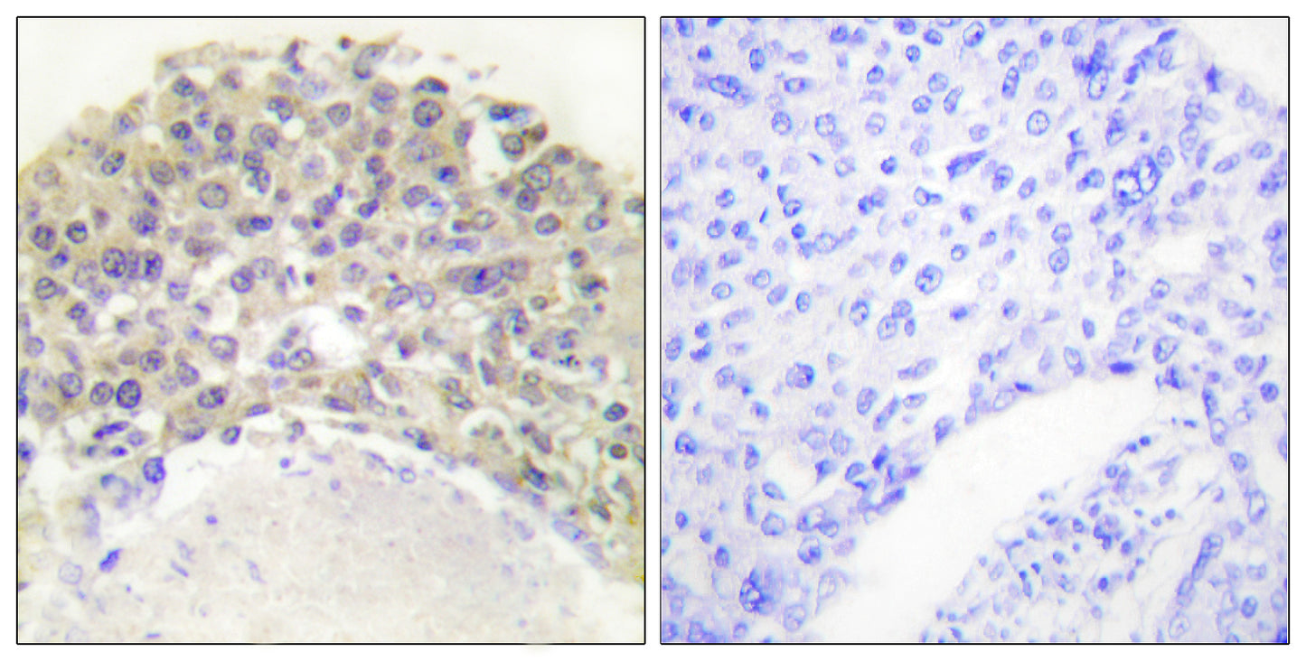 Shc (phospho Tyr349) Rabbit Polyclonal Antibody