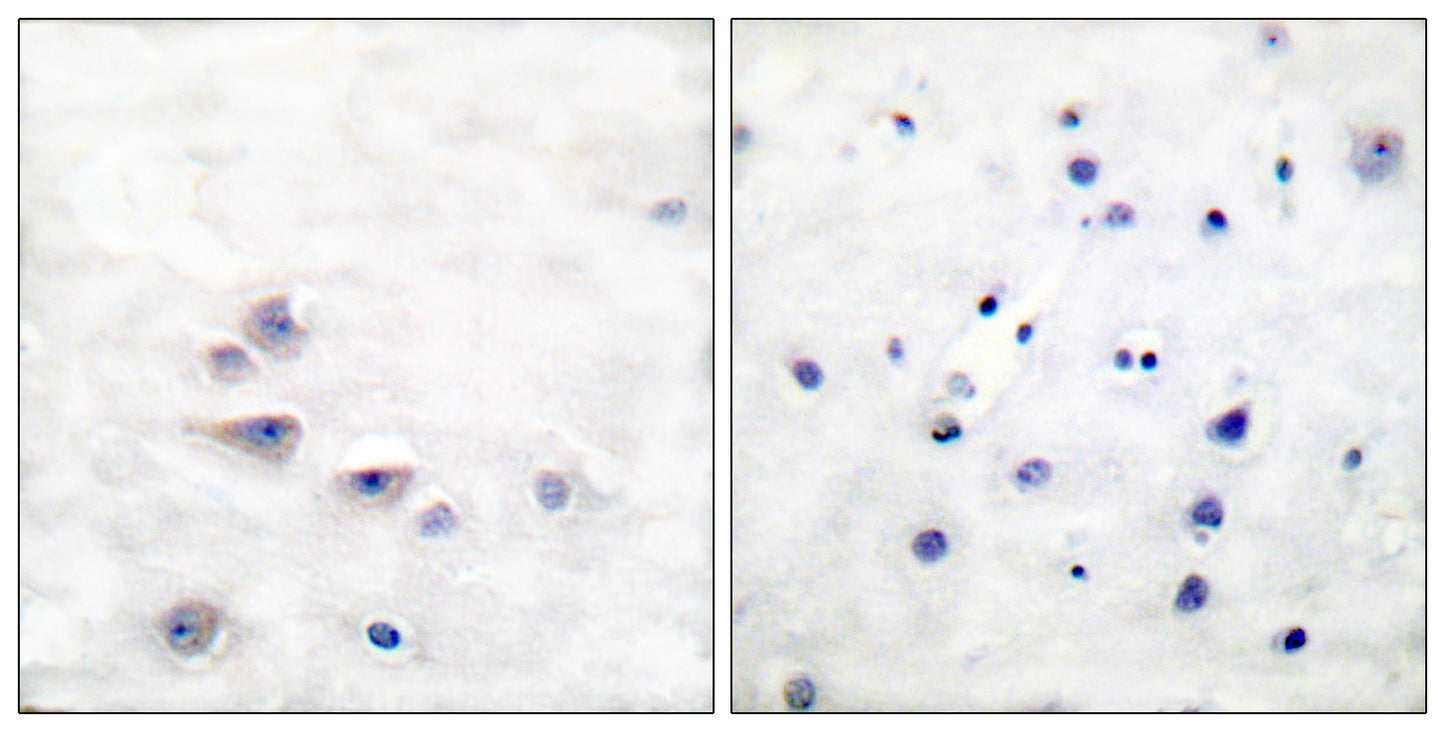 Shc (phospho Tyr427) Rabbit Polyclonal Antibody