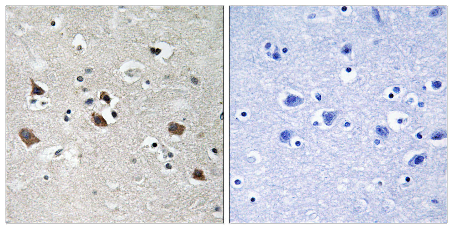SLP-76 (phospho Tyr128) Rabbit Polyclonal Antibody