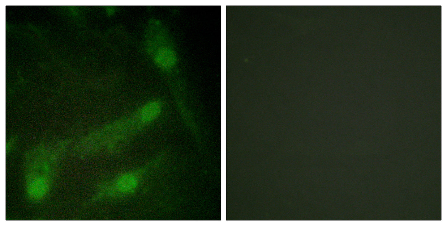 Smad2 (phospho Thr220) Rabbit Polyclonal Antibody
