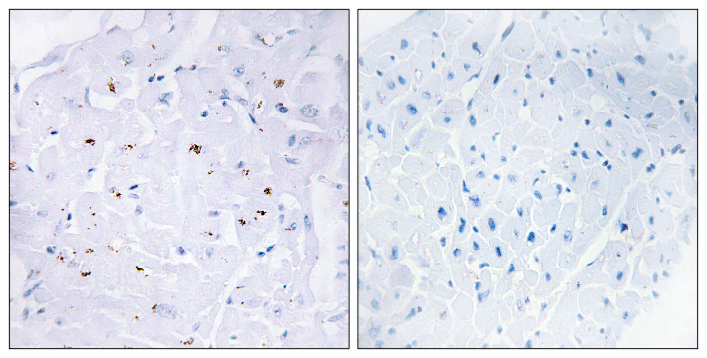 Smad3 (phospho Thr179) Rabbit Polyclonal Antibody