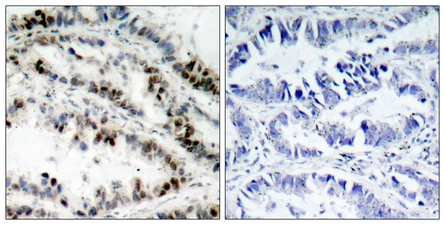 SMC1 (phospho Ser957) Rabbit Polyclonal Antibody