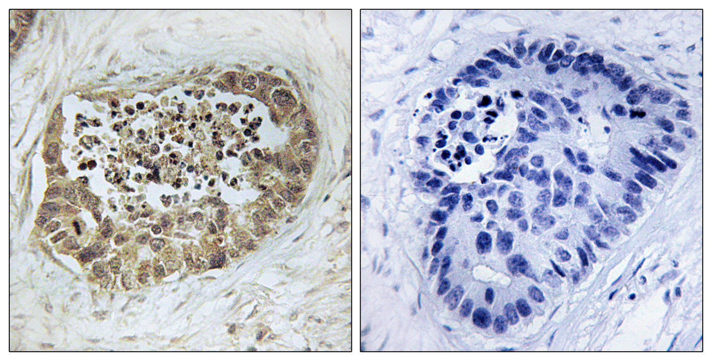 SMC1 (phospho Ser966) Rabbit Polyclonal Antibody