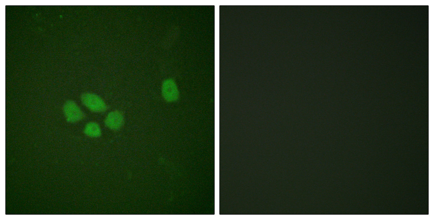 Sox-9 (phospho Ser181) Rabbit Polyclonal Antibody