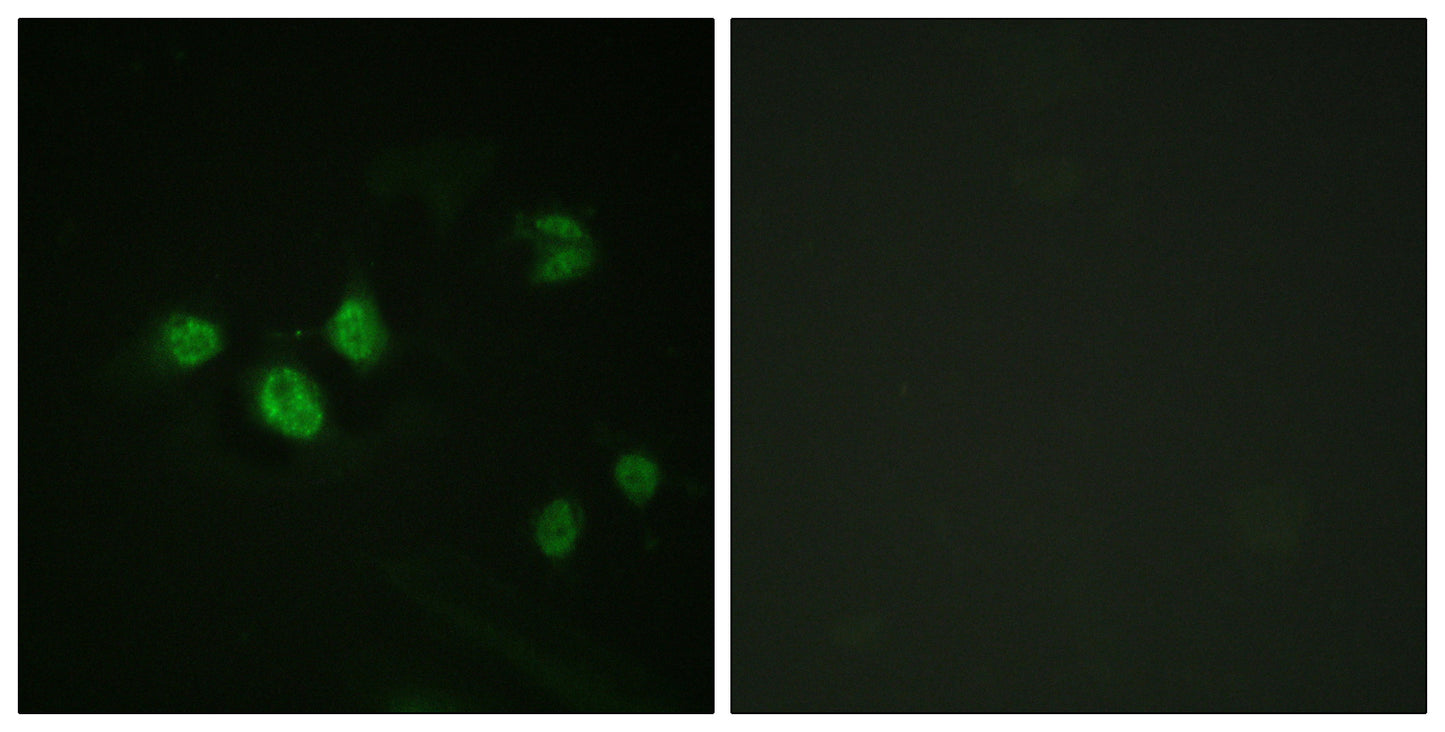 Sp1 (phospho Thr453) Rabbit Polyclonal Antibody