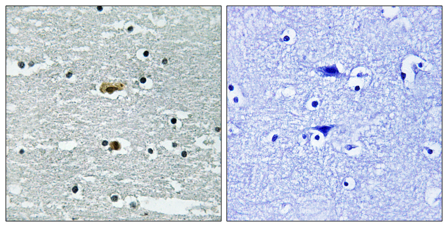 SPAK (phospho Ser311) Rabbit Polyclonal Antibody