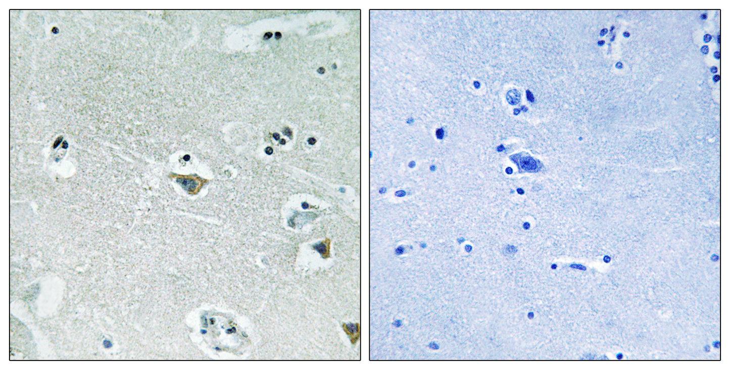SREBP-1 (phospho Ser439) Rabbit Polyclonal Antibody