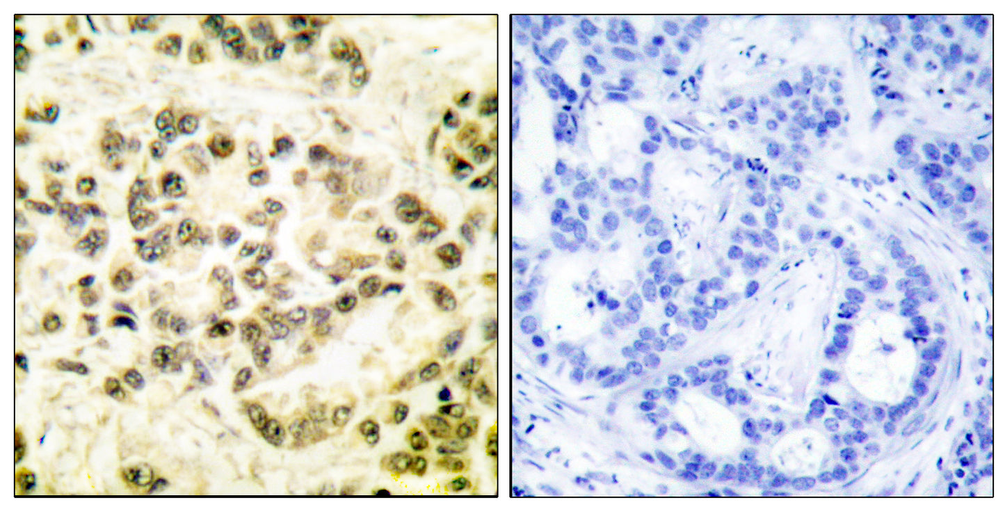 Stat5 (phospho Ser726/731) Rabbit Polyclonal Antibody