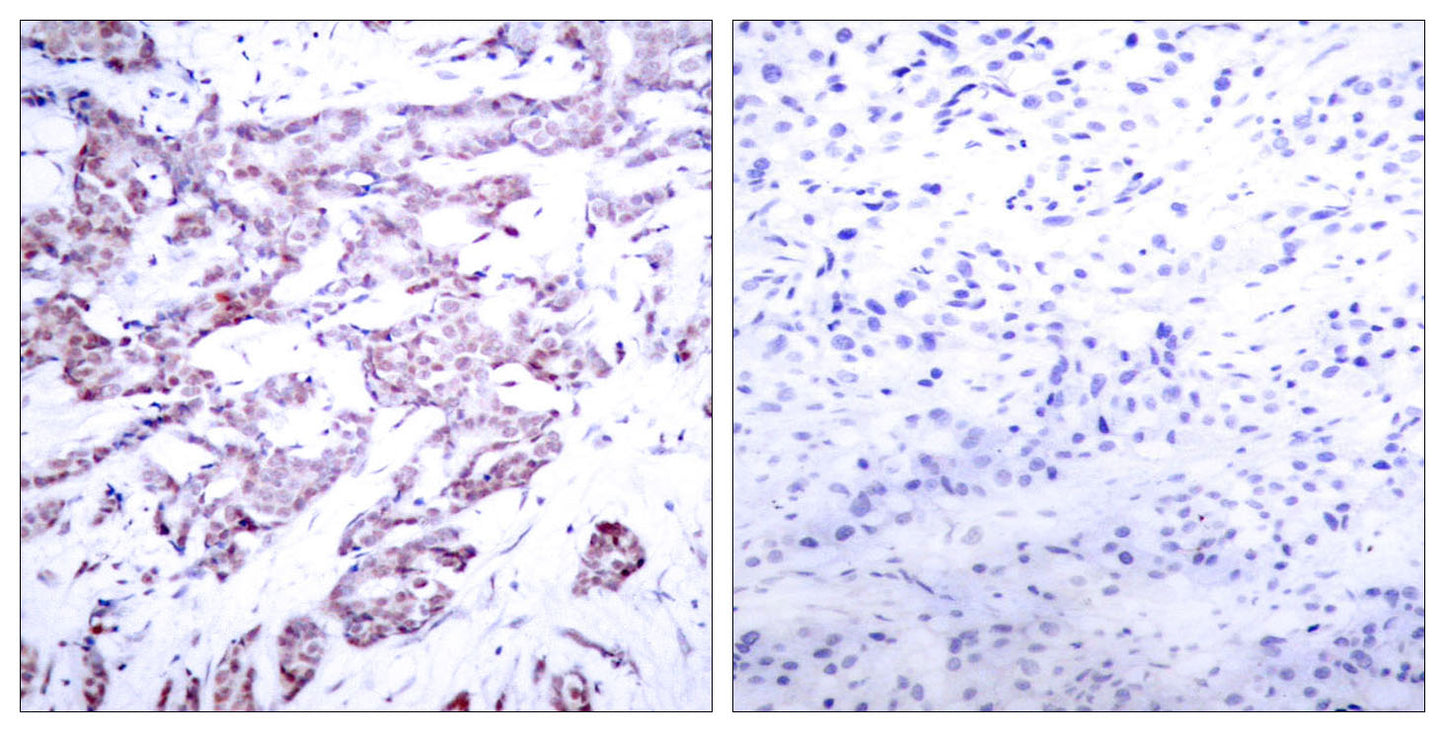Stat6 (phospho Thr645) Rabbit Polyclonal Antibody
