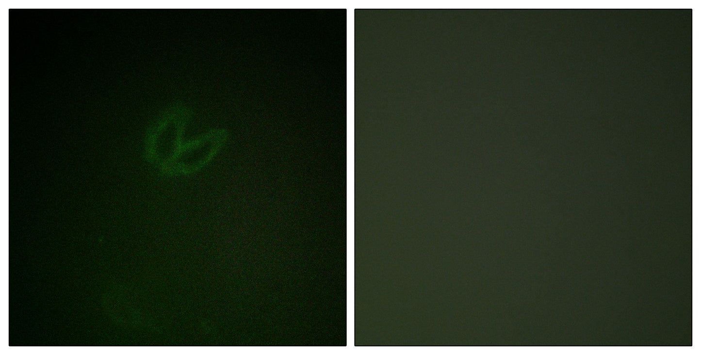 Syk (phospho Tyr323) Rabbit Polyclonal Antibody