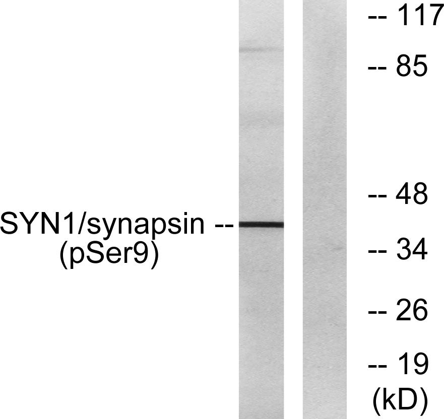 Synapsin I (phospho Ser9) Rabbit Polyclonal Antibody