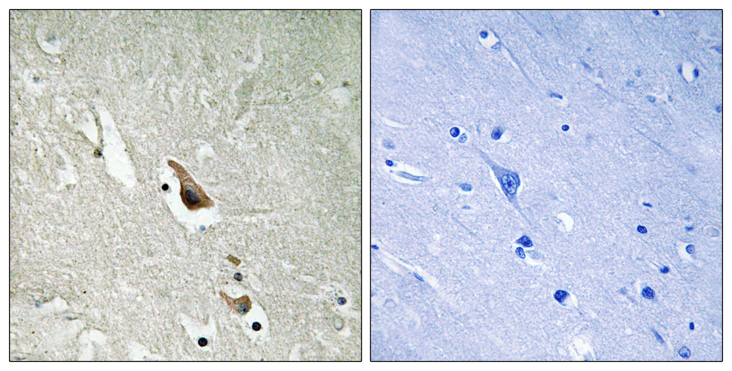 Tak1 (phospho Ser439) Rabbit Polyclonal Antibody