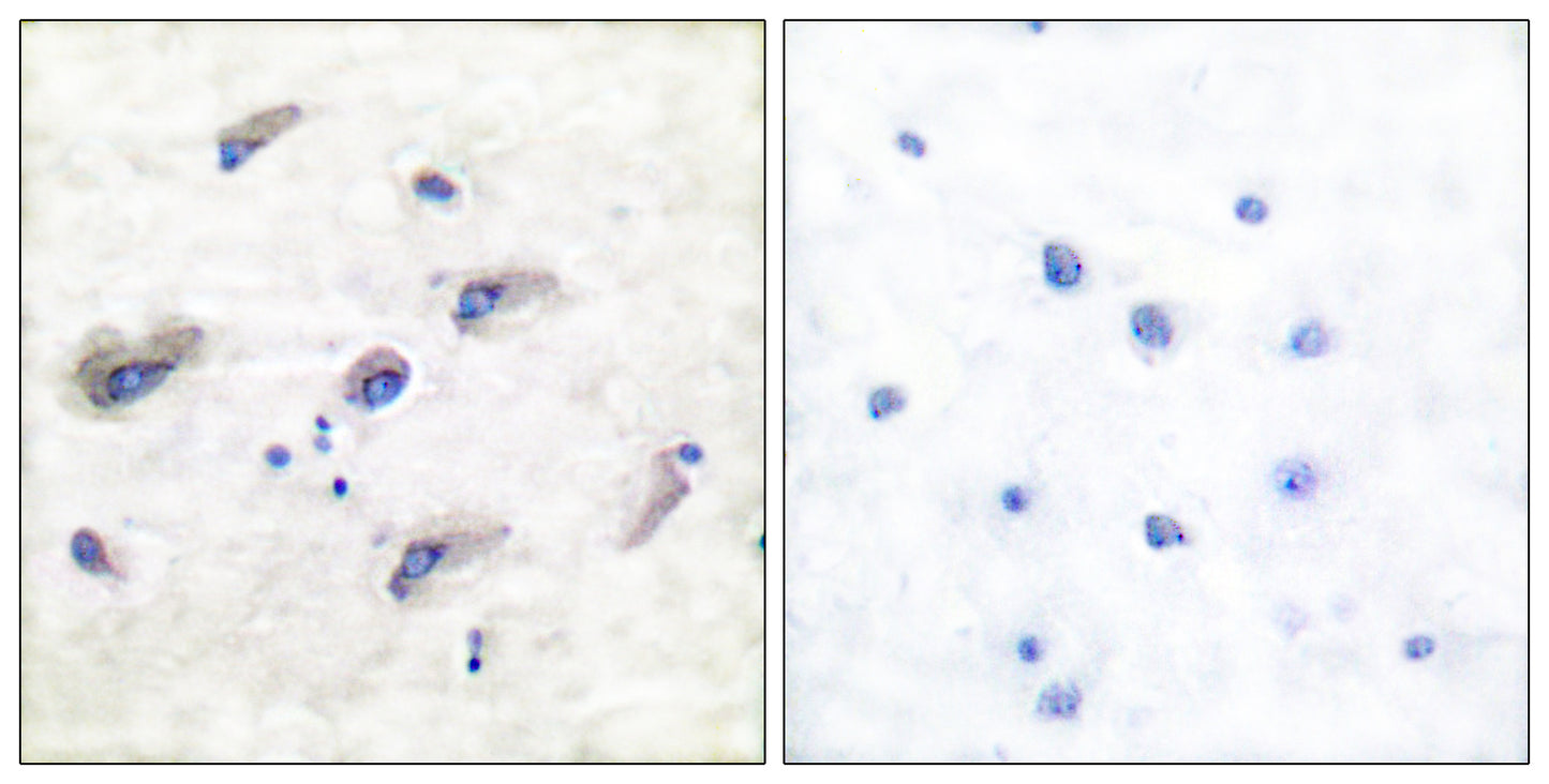 Tau (phospho Ser356) Rabbit Polyclonal Antibody