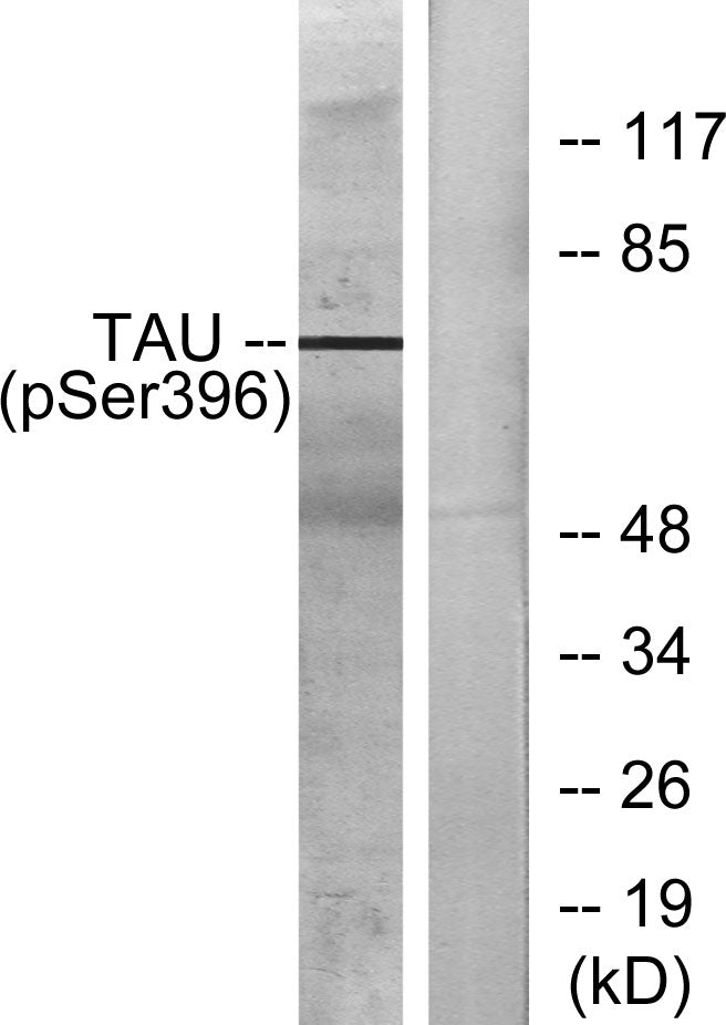 Tau (phospho Ser396) Rabbit Polyclonal Antibody