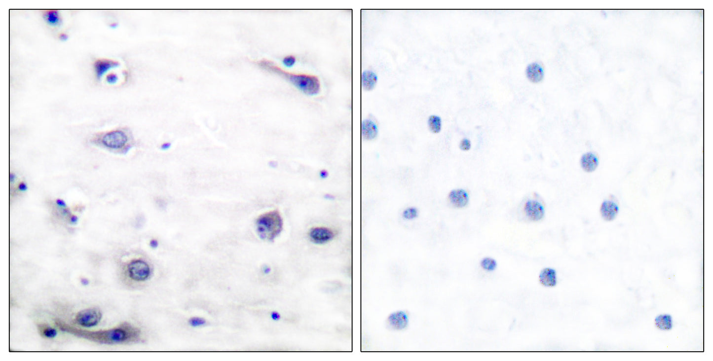 Tau (phospho Ser422) Rabbit Polyclonal Antibody
