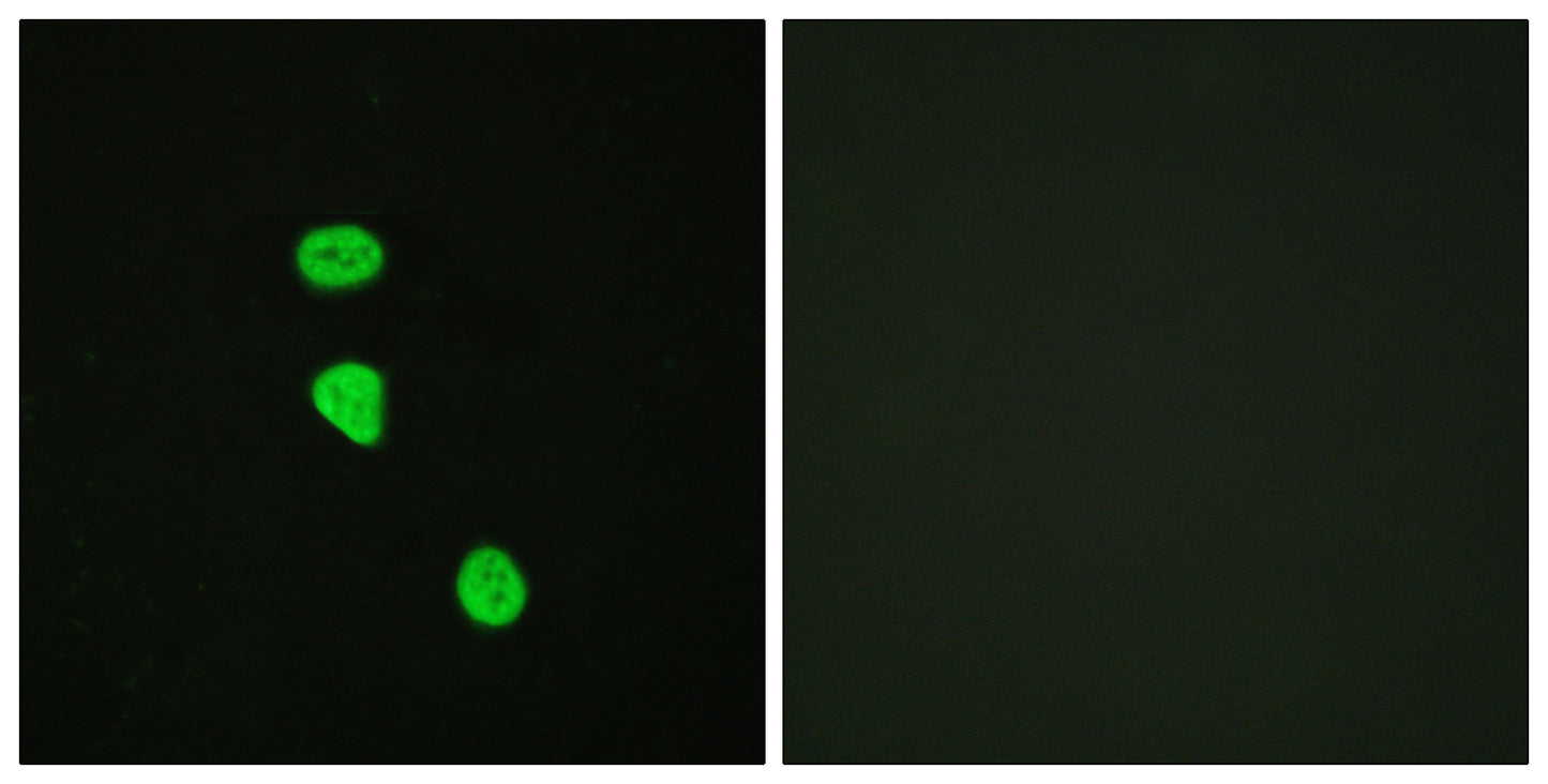 TBC1D4 (phospho Thr642) Rabbit Polyclonal Antibody