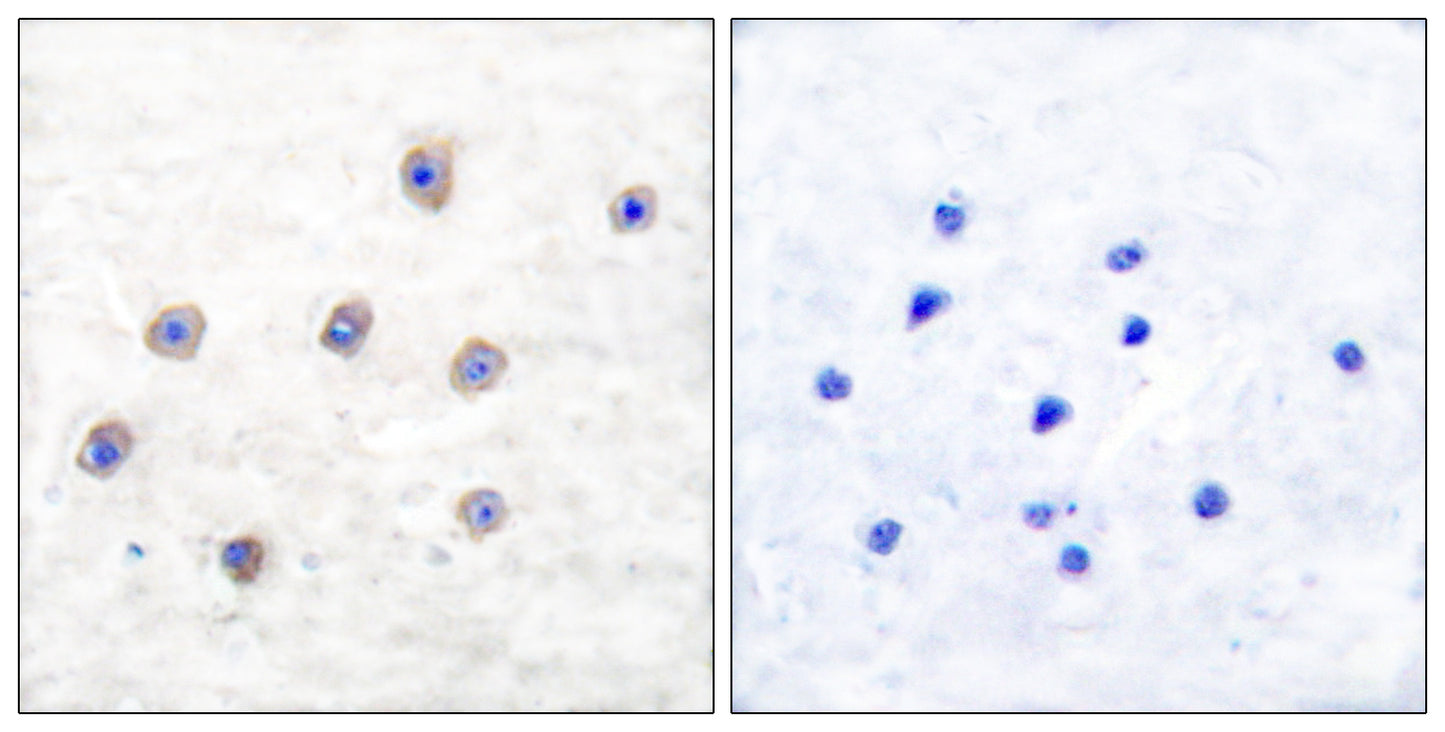 TH (phospho Ser62) Rabbit Polyclonal Antibody