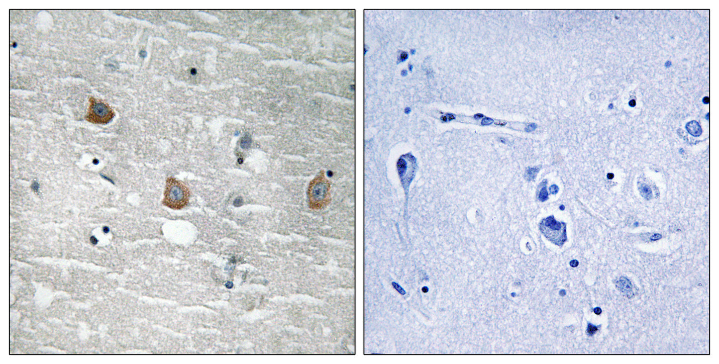 TOB1 (phospho Ser164) Rabbit Polyclonal Antibody