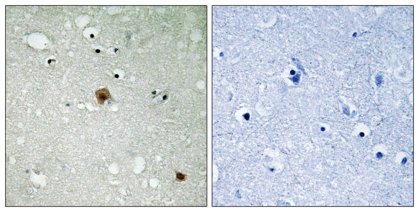 Topo IIα (phospho Ser1525) Rabbit Polyclonal Antibody