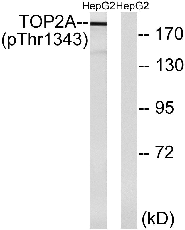 Topo IIα (phospho Thr1343) Rabbit Polyclonal Antibody