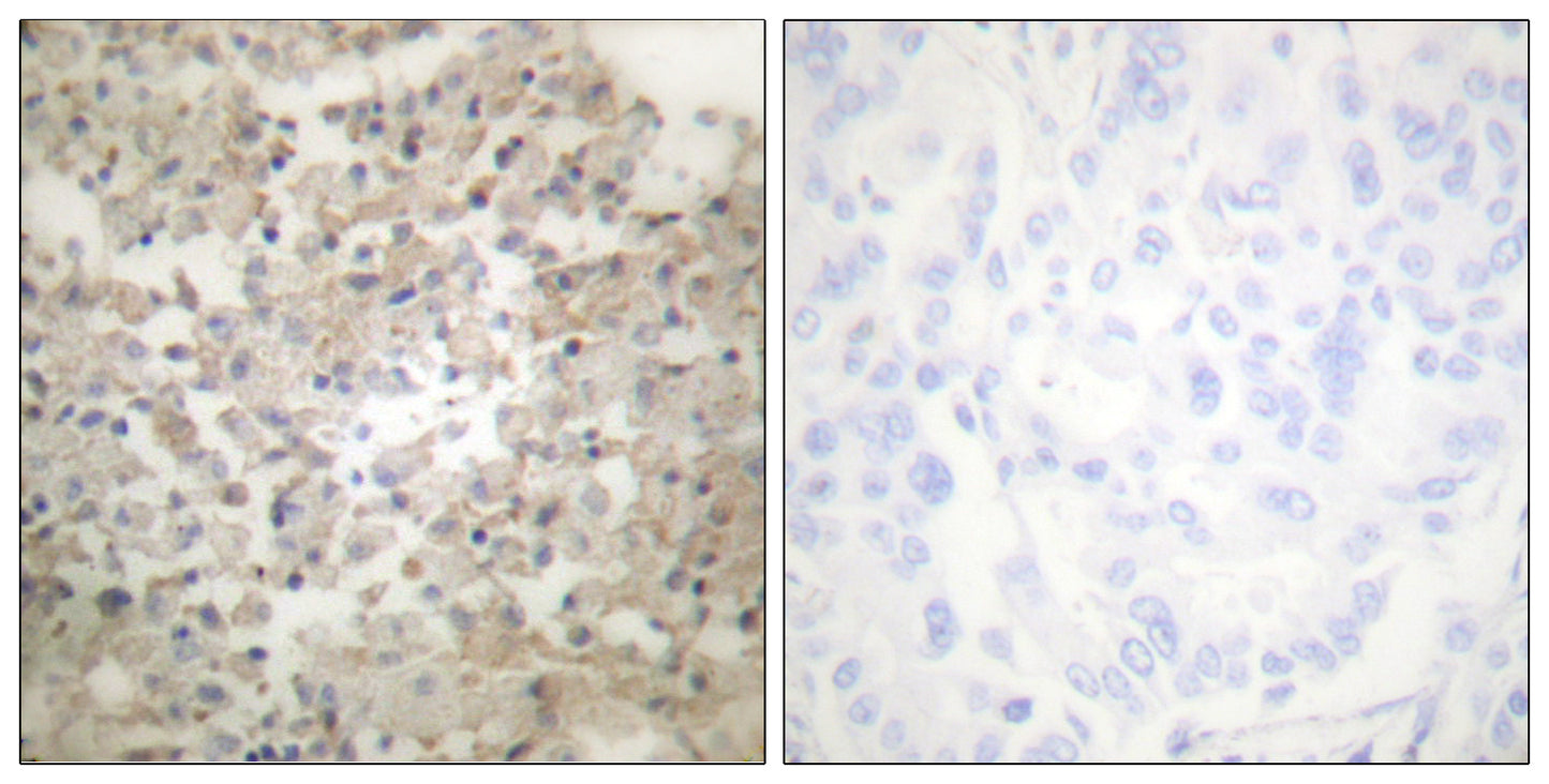 TPH1 (phospho Ser260) Rabbit Polyclonal Antibody