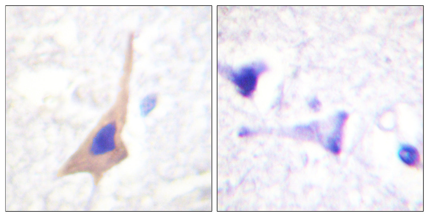 TPH1 (phospho Ser58) Rabbit Polyclonal Antibody