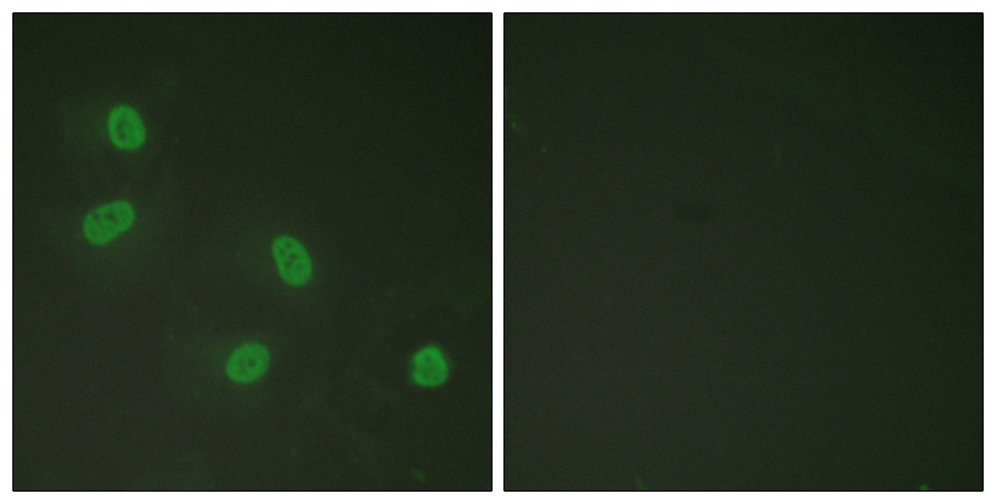 TRAP220 (phospho Thr1457) Rabbit Polyclonal Antibody