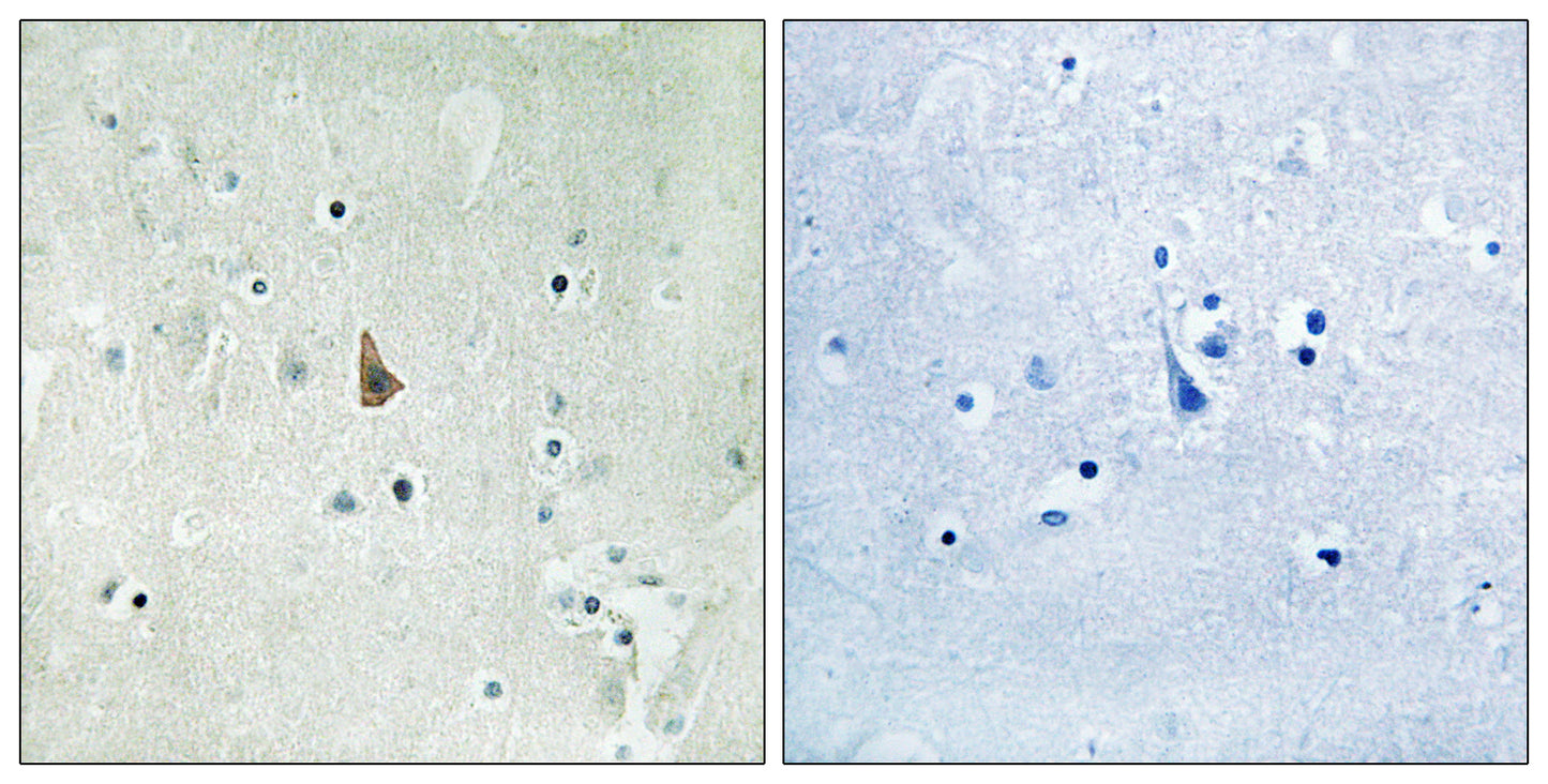 Trk C (phospho Tyr516) Rabbit Polyclonal Antibody