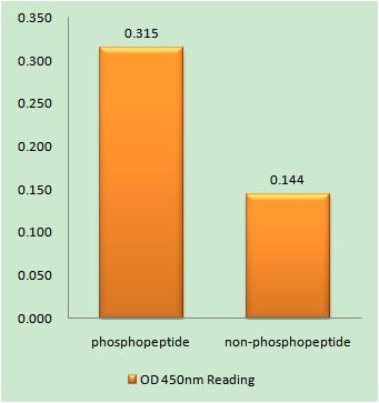 Tuberin (phospho Tyr1571) Rabbit Polyclonal Antibody