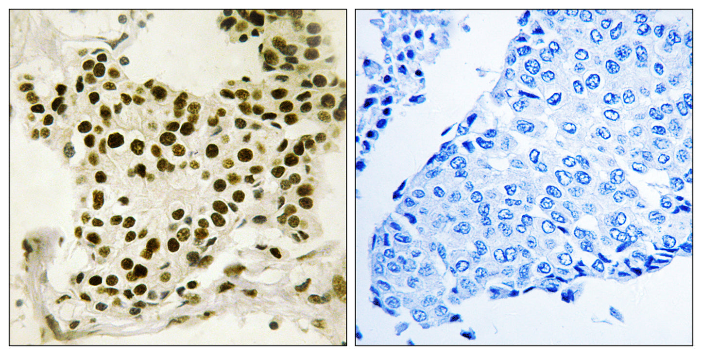 UBF (phospho Ser484) Rabbit Polyclonal Antibody