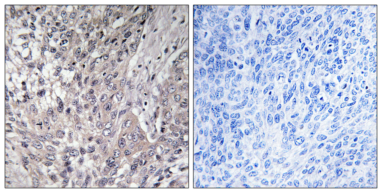VASP (phospho Ser157) Rabbit Polyclonal Antibody