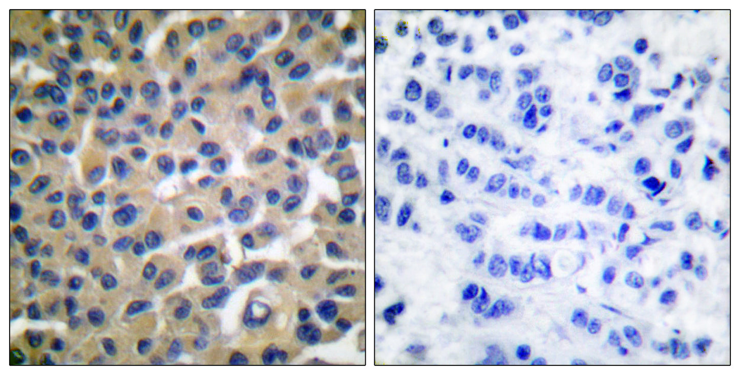 Vav (phospho Tyr174) Rabbit Polyclonal Antibody