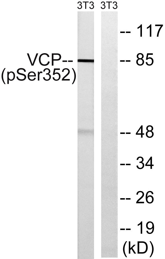 VCP (phospho Ser352) Rabbit Polyclonal Antibody