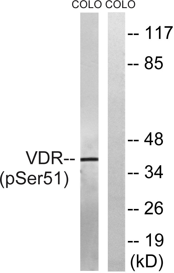 VDR (phospho Ser51) Rabbit Polyclonal Antibody