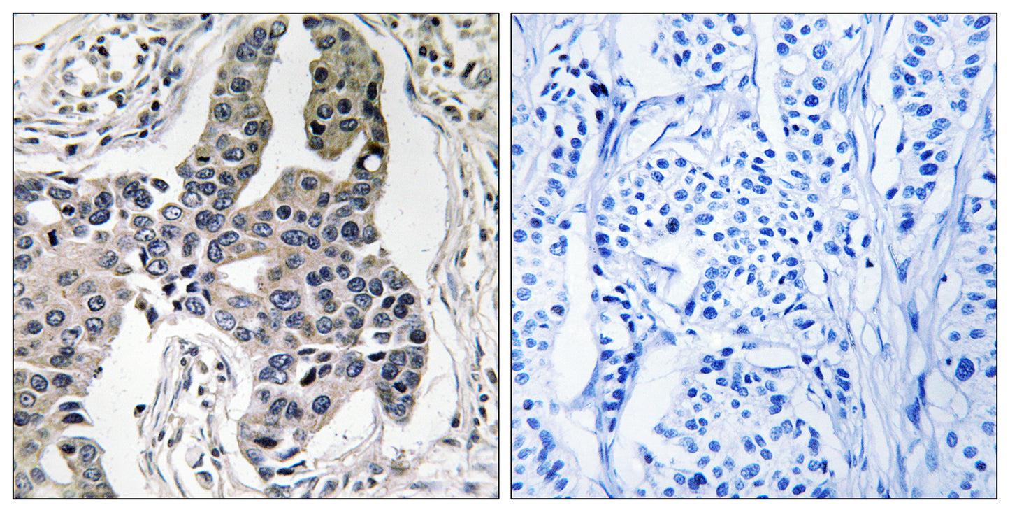 Vimentin (phospho Ser83) Rabbit Polyclonal Antibody