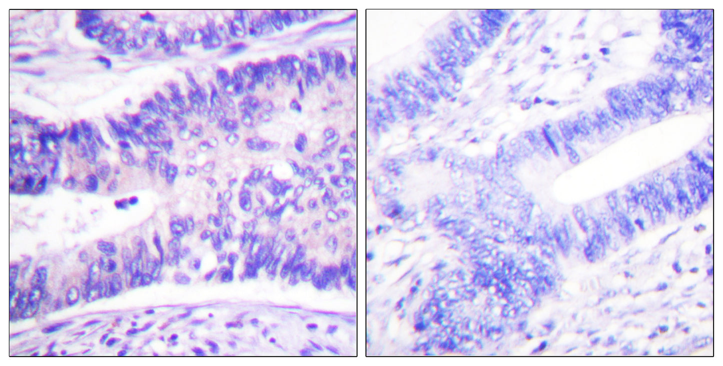 WAVE1 (phospho Tyr125) Rabbit Polyclonal Antibody