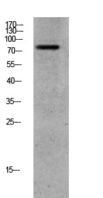 GRK2 (Phospho-Ser685) Rabbit Polyclonal Antibody