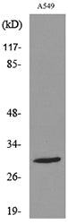 ATF-5 (Acetyl Lys29) Rabbit Polyclonal Antibody