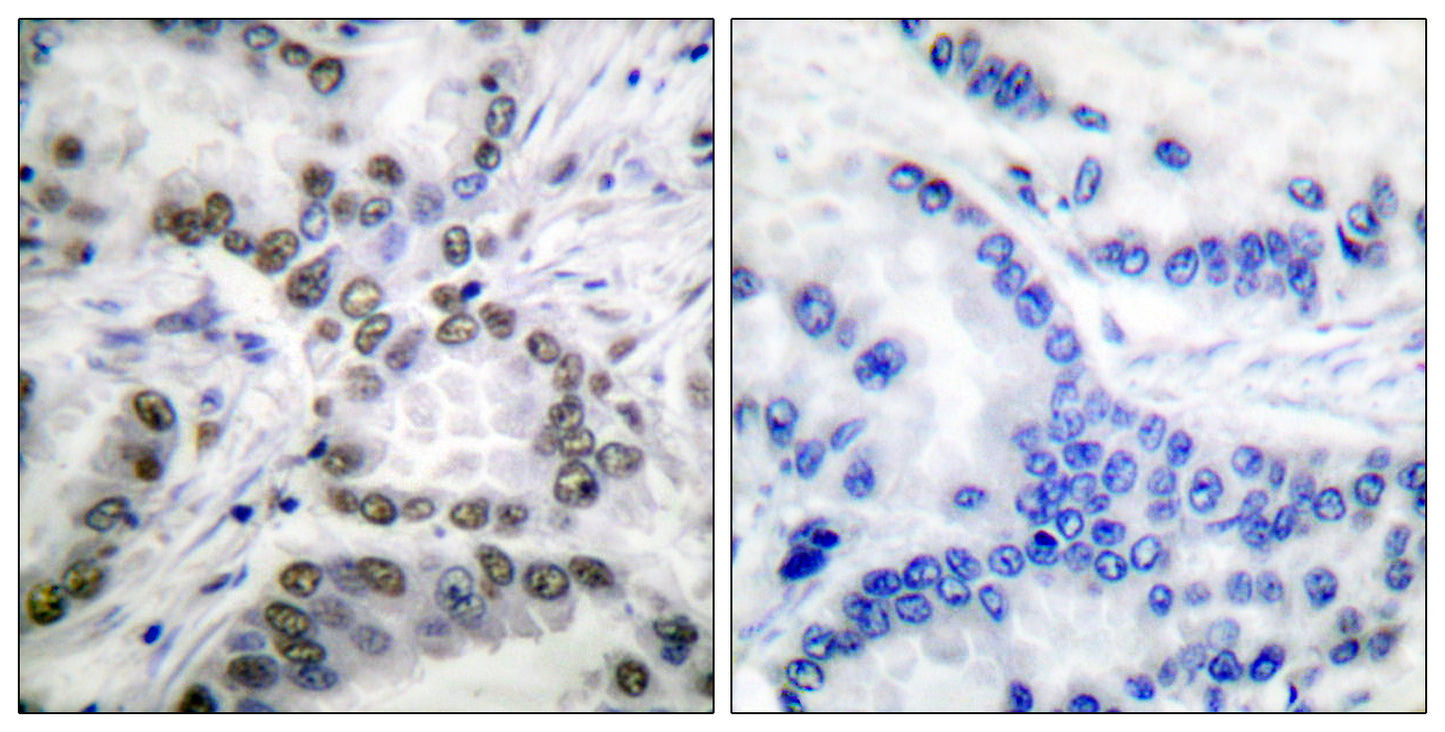 CBP (Acetyl Lys1535) Rabbit Polyclonal Antibody