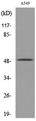 EF-1 α1/2 (Acetyl Lys41) Rabbit Polyclonal Antibody