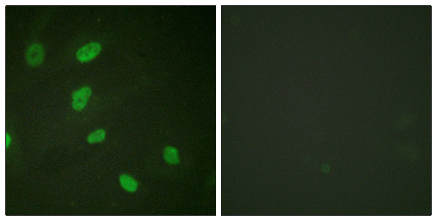 Histone H2B (Acetyl Lys5) Rabbit Polyclonal Antibody