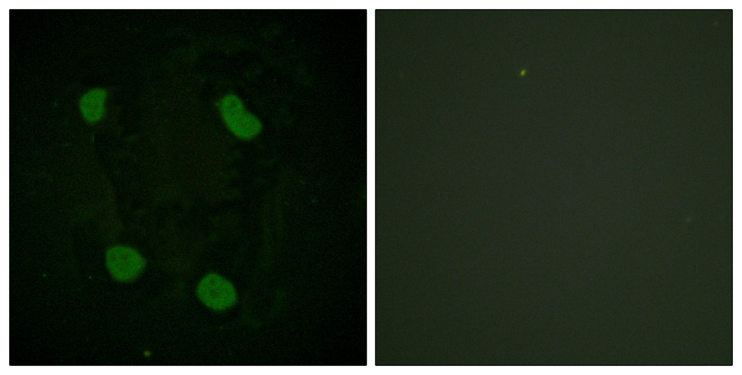 Histone H3 (Acetyl Lys14) Rabbit Polyclonal Antibody