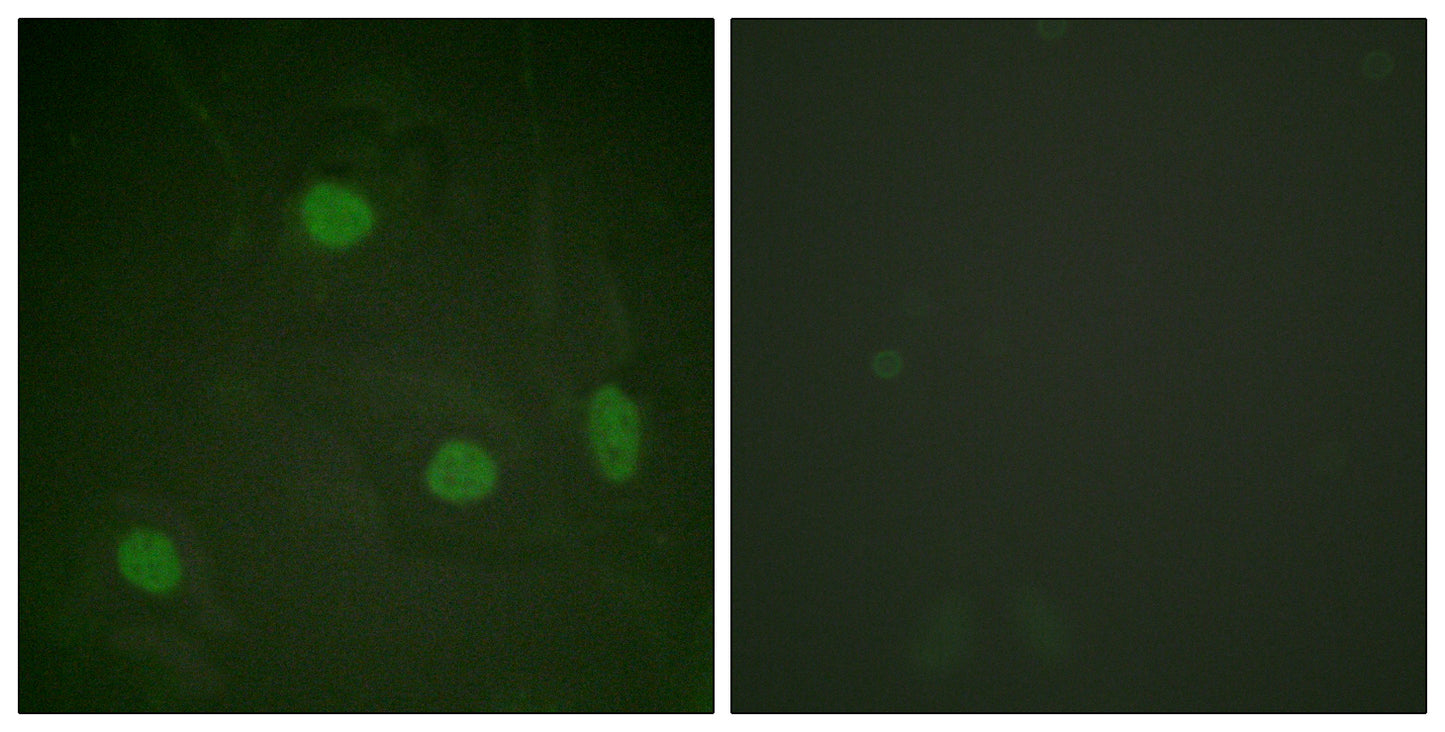 Histone H3 (Acetyl Lys23) Rabbit Polyclonal Antibody