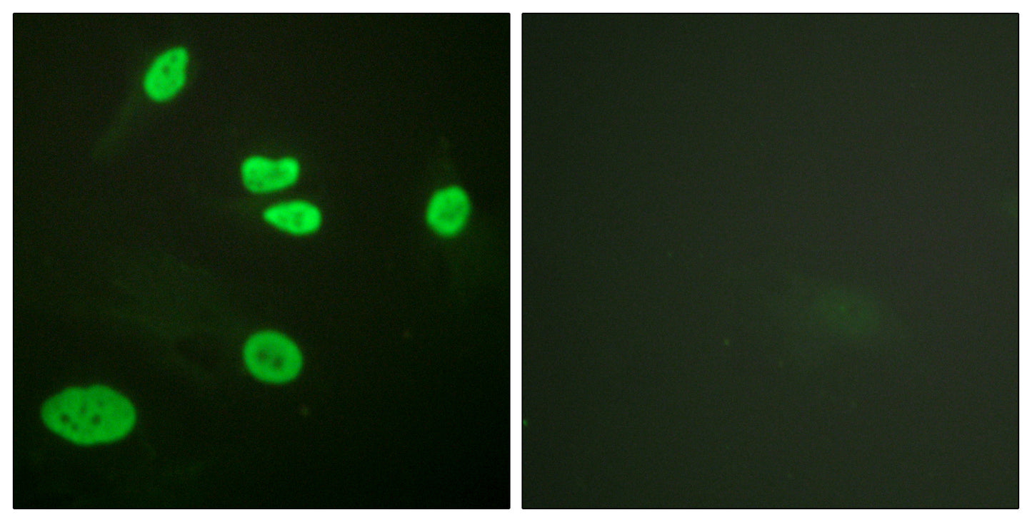 Histone H3 (Acetyl Lys9) Rabbit Polyclonal Antibody