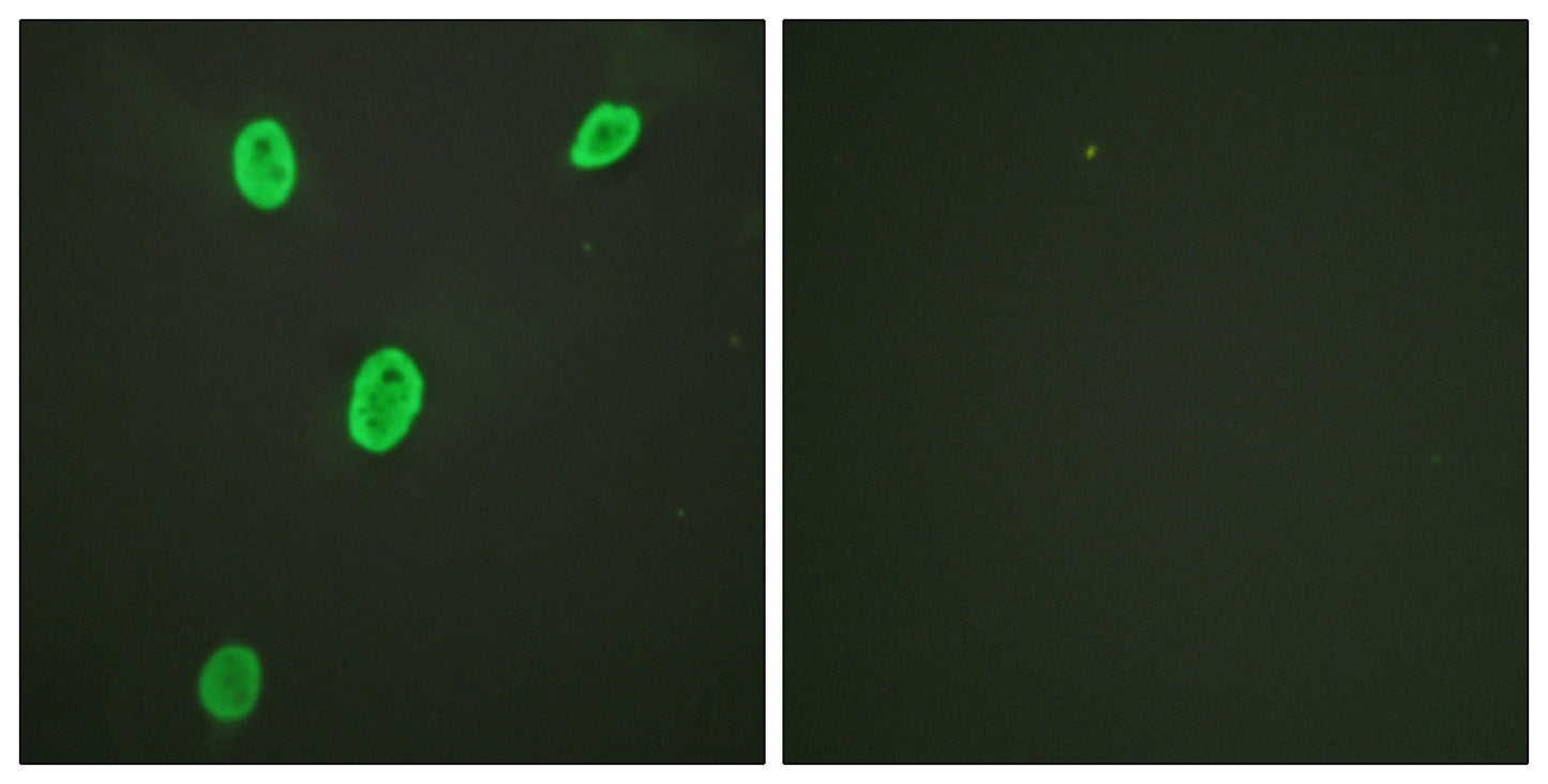 Histone H4 (Acetyl Lys12) Rabbit Polyclonal Antibody