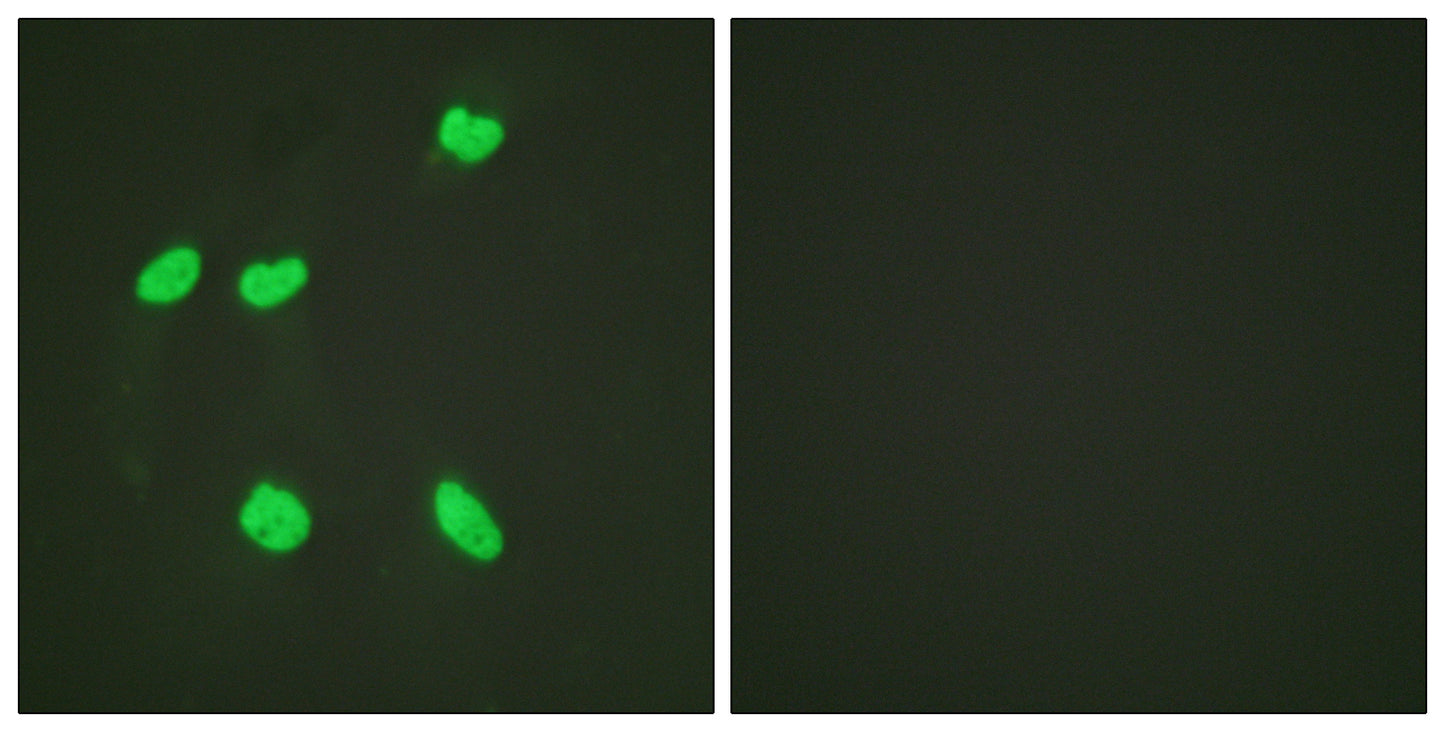 Histone H4 (Acetyl Lys16) Rabbit Polyclonal Antibody